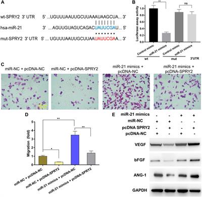 Bone Mesenchymal Stem Cell-Derived sEV-Encapsulated Thermosensitive Hydrogels Accelerate Osteogenesis and Angiogenesis by Release of Exosomal miR-21